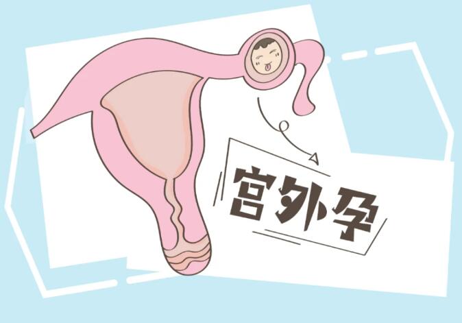試管后如何避免宮外孕（試管嬰兒能避免宮外孕嗎）