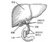 膽囊膽固醇沉著癥 膽囊膽固醇沉著癥