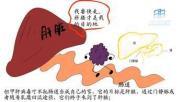 甲型肝炎 甲型肝炎