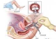 侵襲性指趾乳頭狀腺癌
