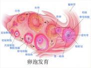 卵巢纖維組織來(lái)源腫瘤 卵巢纖維組織來(lái)源腫瘤
