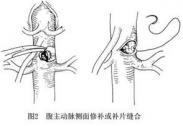 血管損傷