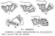 先天性結(jié)腸狹窄和閉鎖