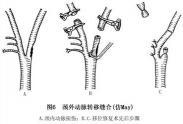 四肢血管損傷
