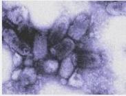 新生兒柯薩奇病毒B感染 新生兒柯薩奇病毒B感染