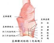 小兒先天性直腸肛門畸形 小兒先天性直腸肛門畸形