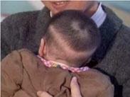 小兒維生素D缺乏性佝僂病 小兒維生素D缺乏性佝僂病