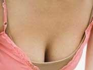 成人型女性乳房肥大癥 成人型女性乳房肥大癥