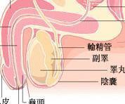 急性附睪炎