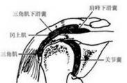 肩峰下滑囊炎