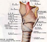 氣管腫瘤 氣管腫瘤