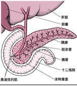 胰高血糖素瘤 胰高血糖素瘤
