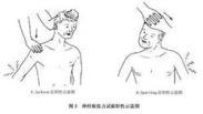 神經根型頸椎病